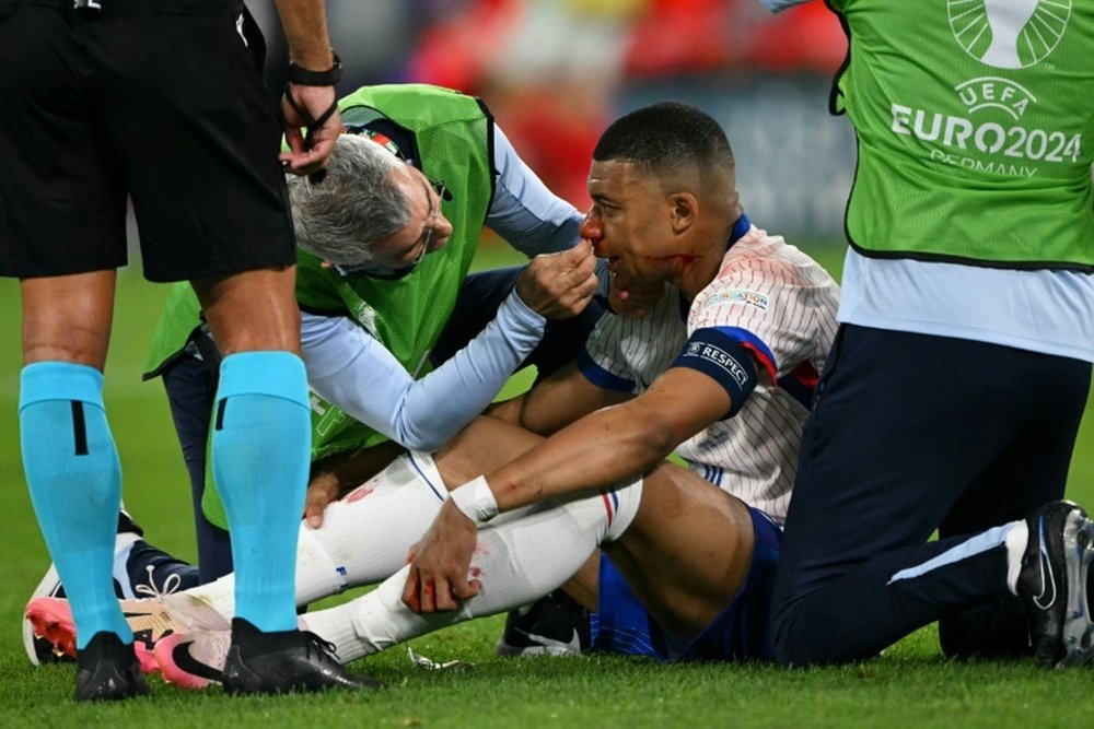 Mbappé sofre ferimento no nariz durante partida contra a Áustria. EFE