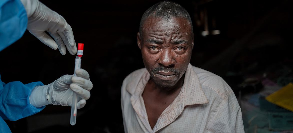 Um homem no leste da República Democrática do Congo tem seu sangue coletado como parte de seu tratamento para mpox