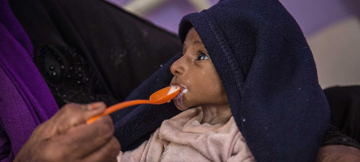 Um bebê de dois meses gravemente desnutrido em Hajjah, no Iêmen, sendo alimentado. O conflito contínuo no Iêmen está levando milhões de pessoas à beira da fome. 15 de novembro de 2018.