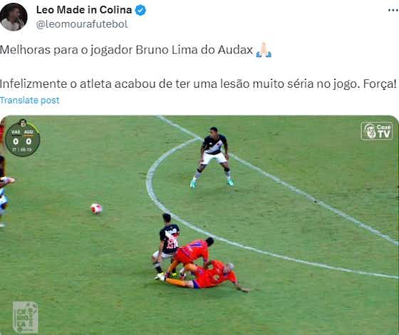 Imagem do artigo:⚠️ Imagens fortes! Web se comove com lance com fratura em jogo do Vasco